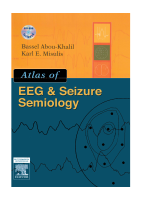 ATLAS OF EEG & SEIZURE SEMIOLOGY.pdf